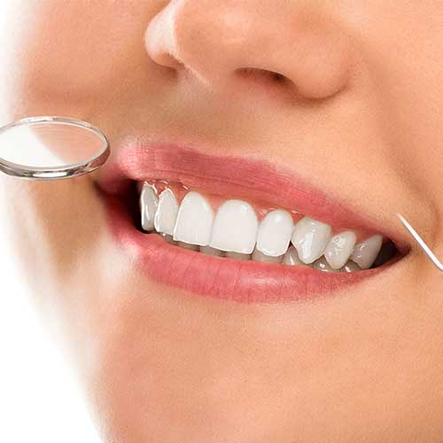 Accessori-per-la-pulizia-denti