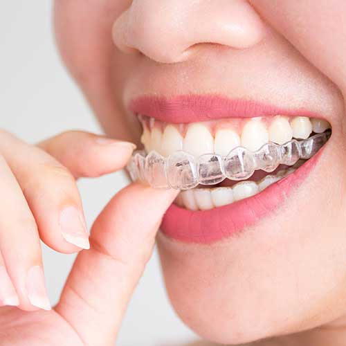 Accessori-per-apparecchi